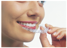 Invisalign braces